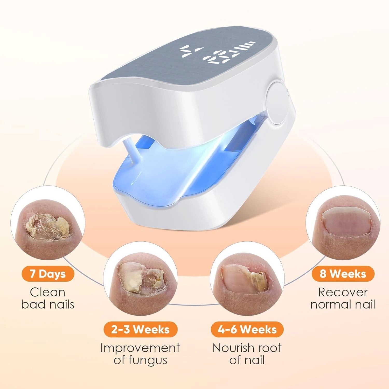 1Pcs Effective Rechargeable Nail Fungus Remover Nail Fungus Cleaning Laser Device Repair Damaged Discolored Thick Fingernails